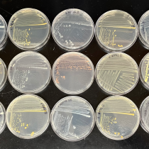 Petri dishes of bacteria cultures
