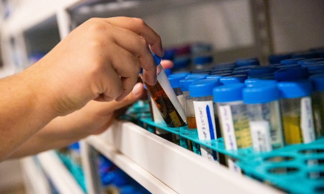 Person pulling alcohol specimens