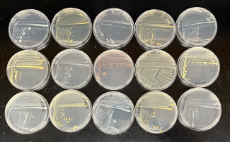 Petri dishes of bacteria cultures
